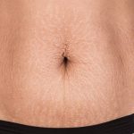 How To Make A Stretch Mark Scrub At Home: 10 Recipes That Works